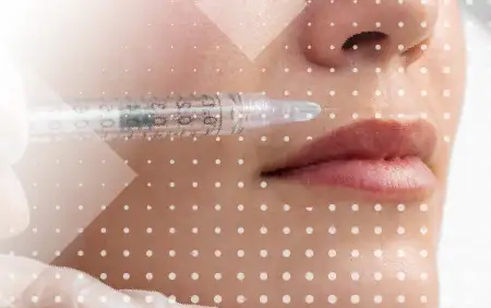 Gana volumen labial con Ácido Hialurónico