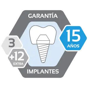Garantías en tu clínica dental - Garantía de implantes