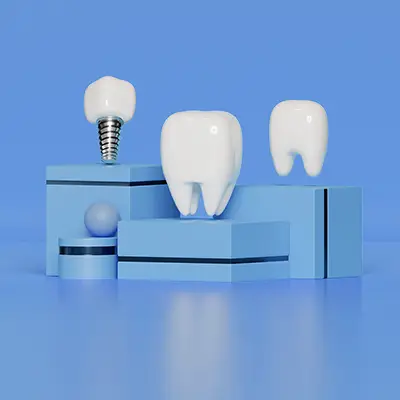 Tipos de prótesis dentales